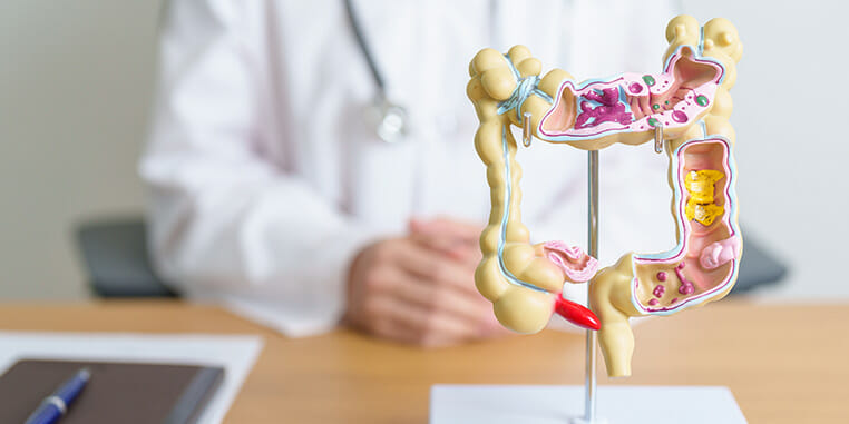 Lifestyle factors for the prevention and care of people with inflammatory bowel disease