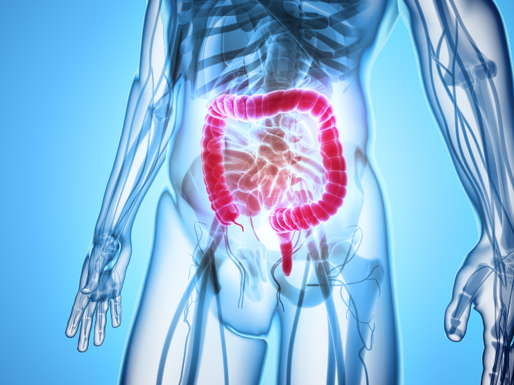 Understanding Inflammatory Bowel Disease (IBD): Causes, symptoms and support