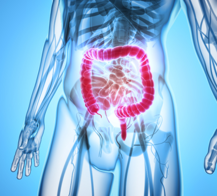 Understanding Inflammatory Bowel Disease (IBD): Causes, symptoms and support